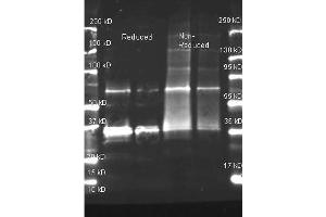 Goat anti Uricase antibody was used to detect purified Uricase under reducing and non-reducing conditions. (Urate Oxidase Antikörper  (Biotin))