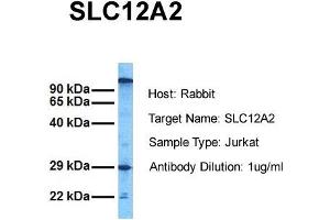 Host: Rabbit Target Name: SLC12A2 Sample Tissue: Human Jurkat Antibody Dilution: 1. (SLC12A2 Antikörper  (C-Term))