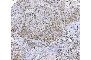 IHC analysis of JHDM3A/JMJD2A/KDM4A using anti-JHDM3A/JMJD2A/KDM4A antibody (ABIN7601534).