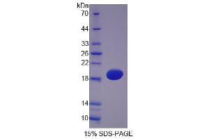 Image no. 1 for Hemoglobin, alpha 1 (HBA1) (AA 1-142) protein (His tag) (ABIN4989714)