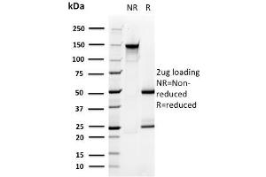 SDS-PAGE Analysis Purified PMEPA1 Mouse Monoclonal Antibody (PMEPA1/2696). (PMEPA1 Antikörper)