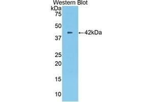 Detection of recombinant CPB2 using Polyclonal Antibody to Carboxypeptidase B2 (CPB2) (CPB2 Antikörper  (AA 113-422))
