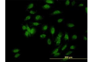 Immunofluorescence of monoclonal antibody to UBE3A on HeLa cell. (ube3a Antikörper  (AA 51-150))
