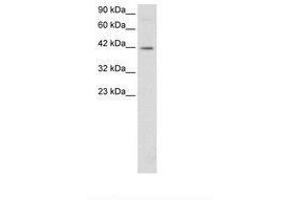 Image no. 3 for anti-FOS-Like Antigen 2 (FOSL2) (AA 208-256) antibody (ABIN6735784) (FOSL2 Antikörper  (AA 208-256))