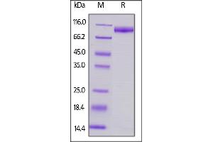 SDS-PAGE (SDS) image for Signal-Regulatory Protein alpha (SIRPA) (AA 32-373) protein (Fc Tag) (ABIN6253543)