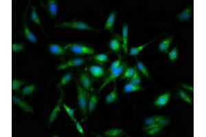 Immunofluorescent analysis of Hela cells using ABIN7165698 at dilution of 1:100 and Alexa Fluor 488-congugated AffiniPure Goat Anti-Rabbit IgG(H+L) (PKC beta Antikörper  (AA 517-643))