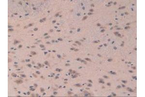 Detection of EIF3A in Mouse Brain Tissue using Polyclonal Antibody to Eukaryotic Translation Initiation Factor 3A (EIF3A) (EIF6 Antikörper  (AA 622-848))