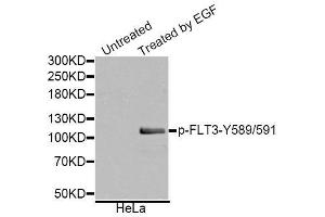 Western blot analysis of extracts of various cell lines, using Phospho-FLT3-Y589/591 antibody (ABIN5995603). (FLT3 Antikörper  (pTyr589, pTyr591))
