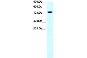 Human Jurkat; WB Suggested Anti-SLC17A2 Antibody Titration: 0. (SLC17A2 Antikörper  (Middle Region))