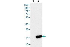 Western blot analysis of Lane 1: Negative control (vector only transfected HEK293T lysate), Lane 2: Over-expression Lysate (Co-expressed with a C-terminal myc-DDK tag (~3. (PLGRKT Antikörper)