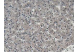 DAB staining on IHC-P; Samples: Porcine Liver Tissue (ORM1 Antikörper  (AA 2-171))