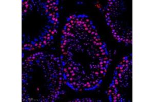 Immunofluorescence of paraffin embedded mouse testis using SNRNP200 (ABIN7075632) at dilution of 1: 650 (250x lens) (SNRNP200 Antikörper)