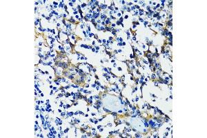 Immunohistochemistry of paraffin-embedded human tonsil using HD antibody (ABIN6133742, ABIN6141675, ABIN6141678 and ABIN6213911) at dilution of 1:100 (40x lens). (HDAC5 Antikörper  (AA 550-650))