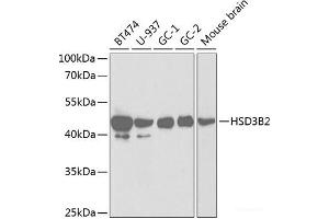Western blot analysis of extracts of various cell lines using HSD3B2 Polyclonal Antibody at dilution of 1:1000. (HSD3B2 Antikörper)