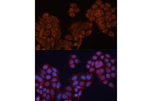 Immunofluorescence analysis of HeLa cells using  antibody (ABIN6127341, ABIN6136780, ABIN6136781 and ABIN6220209) at dilution of 1:100. (ALDH6A1 Antikörper  (AA 326-535))