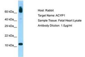 Image no. 1 for anti-Acylphosphatase 1, Erythrocyte (Common) Type (Acyp1) (AA 36-85) antibody (ABIN6750083) (ACYP1 Antikörper  (AA 36-85))