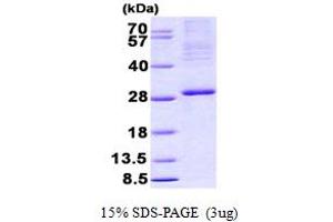 SDS-PAGE (SDS) image for Integrin beta 3 Binding Protein (Beta3-Endonexin) (ITGB3BP) (AA 1-216) protein (His tag) (ABIN6387171) (ITGB3BP Protein (AA 1-216) (His tag))