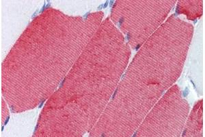 Human Skeletal Muscle (formalin-fixed, paraffin-embedded) stained with TNNT3 antibody ABIN462336 followed by biotinylated anti-mouse IgG secondary antibody ABIN481714, alkaline phosphatase-streptavidin and chromogen. (TNNT3 Antikörper)