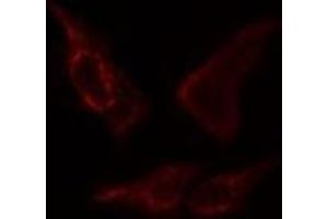 ABIN6276392 staining  COLO205 cells by IF/ICC.