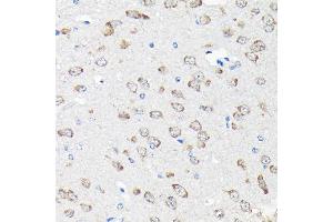 Immunohistochemistry (IHC) image for anti-Ribosomal Protein S15a (RA) (AA 1-130) antibody (ABIN6147201)