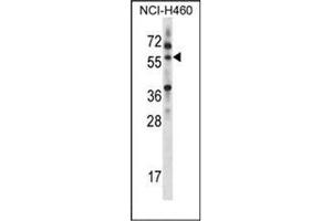 Western blot analysis of MINPP1 Antibody (C-term) in NCI-H460 cell line lysates (35ug/lane). (MINPP1 Antikörper  (C-Term))