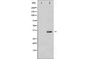 Western blot analysis of CDK5 phosphorylation expression in EGF treated COS7 whole cell lysates,The lane on the left is treated with the antigen-specific peptide.