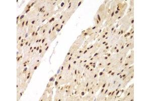 Immunohistochemistry of paraffin-embedded Human colon using SUPT20H Polyclonal Antibody at dilution of 1:100 (40x lens).