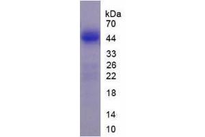 Image no. 2 for Lemur Tyrosine Kinase 3 (LMTK3) (AA 133-411) (Active) protein (His tag) (ABIN6239743) (LMTK3 Protein (AA 133-411) (His tag))