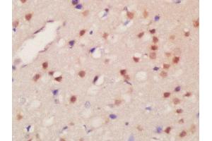 Formalin-fixed and paraffin embedded rat brain labeled with Rabbit Anti-JMJD2B(Thr305) Polyclonal Antibody, Unconjugated  at 1:200 followed by conjugation to the secondary antibody and DAB staining