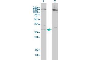 Western Blot analysis of BCL7B expression in transfected 293T cell line by BCL7B monoclonal antibody (M01), clone 6D2.