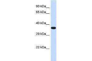 Western Blotting (WB) image for anti-Transducer of ERBB2, 2 (TOB2) (Middle Region) antibody (ABIN2774214) (TOB2 Antikörper  (Middle Region))