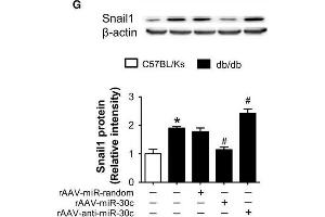 Snail1 is a target of miR-30c. (SNAIL Antikörper  (C-Term))