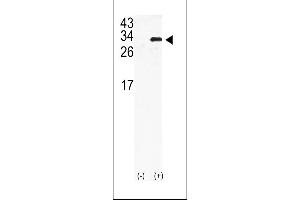 Western blot analysis of GJB6 using rabbit polyclonal GJB6 Antibody using 293 cell lysates (2 ug/lane) either nontransfected (Lane 1) or transiently transfected with the GJB6gene (Lane 2). (GJB6 Antikörper  (N-Term))