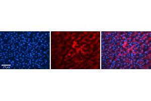 HP (haptoglobin)antibody - N-terminal region          Formalin Fixed Paraffin Embedded Tissue:  Human Liver Tissue    Observed Staining:  Cytoplasm in hepatocytes   Primary Antibody Concentration:  1:100    Secondary Antibody:  Donkey anti-Rabbit-Cy3    Secondary Antibody Concentration:  1:200    Magnification:  20X    Exposure Time:  0. (Haptoglobin Antikörper  (N-Term))