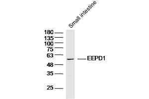 Mouse small intestine lysates probed with EEPD1 Polyclonal Antibody, Unconjugated  at 1:300 dilution and 4˚C overnight incubation. (EEPD1 Antikörper  (AA 9-100))