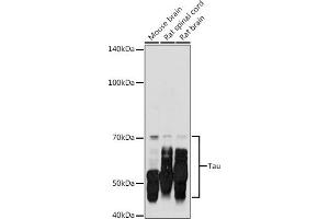 Western blot analysis of extracts of various cell lines, using Tau antibody (ABIN3021441, ABIN3021442, ABIN3021443 and ABIN6215045) at 1:500 dilution. (MAPT Antikörper  (AA 1-100))