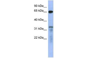 WB Suggested Anti-RAP1GAP Antibody Titration: 0. (RAP1GAP Antikörper  (Middle Region))