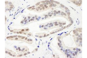 Immunohistochemistry (IHC) image for anti-Chromodomain Helicase DNA Binding Protein 3 (CHD3) (AA 1950-2000) antibody (ABIN7448475)