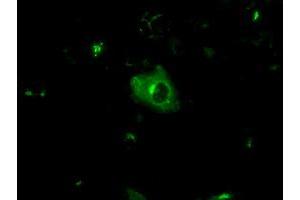 Immunofluorescence (IF) image for anti-Amyloid beta (A4) Precursor Protein (APP) antibody (ABIN1496875) (APP Antikörper)
