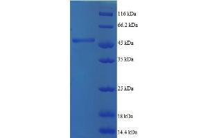 SDS-PAGE (SDS) image for ADP-Ribosylation Factor 5 (ARF5) (AA 2-180) protein (GST tag) (ABIN5712091) (ARF5 Protein (AA 2-180) (GST tag))