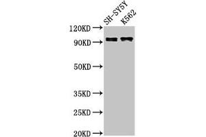 Western Blot Positive WB detected in: SH-SY5Y whole cell lysate, K562 whole cell lysate All lanes: KCNQ3 antibody at 3 μg/mL Secondary Goat polyclonal to rabbit IgG at 1/50000 dilution Predicted band size: 97, 85 kDa Observed band size: 97 kDa (KCNQ3 Antikörper  (AA 763-872))