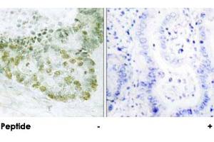 Immunohistochemical analysis of paraffin-embedded human heart tissue using TGFB1I1 polyclonal antibody . (TGFB1I1 Antikörper)