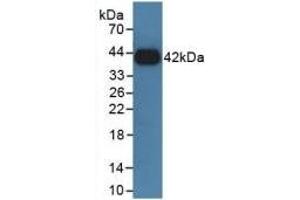 Detection of Recombinant GHR, Rat using Polyclonal Antibody to Growth Hormone Receptor (GHR) (Growth Hormone Receptor Antikörper  (AA 353-588))