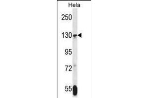 Western blot analysis in Hela cell line lysates (35ug/lane). (TNKS Antikörper  (N-Term))