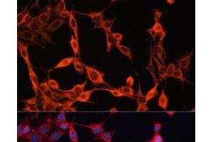 Immunofluorescence (IF) image for anti-Solute Carrier Family 25 (Mitochondrial Carrier, Phosphate Carrier), Member 23 (SLC25A23) antibody (ABIN7257814)