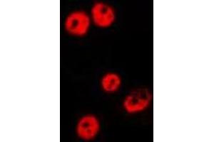 ABIN6275487 staining HepG2 by IF/ICC. (RBBP5 Antikörper  (Internal Region))
