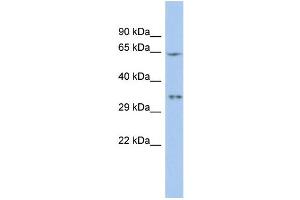 WB Suggested Anti-MIF4GD Antibody Titration:  0. (MIF4GD Antikörper  (N-Term))