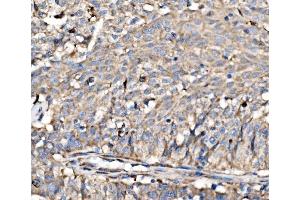 IHC analysis of RPL17 using anti-RPL17 antibody (ABIN7601639). (RPL17 Antikörper  (AA 40-167))