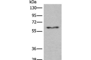 Western blot analysis of Human fetal liver tissue lysate using CES2 Polyclonal Antibody at dilution of 1:600 (CES2 Antikörper)