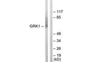 Western blot analysis of extracts from COLO205 cells, using GRK1 (Ab-21) Antibody.